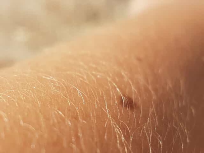 Skin and arm hair
